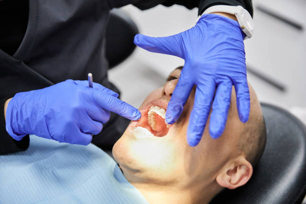 Best Emergency Treatment for Toothache in Ruston, WA